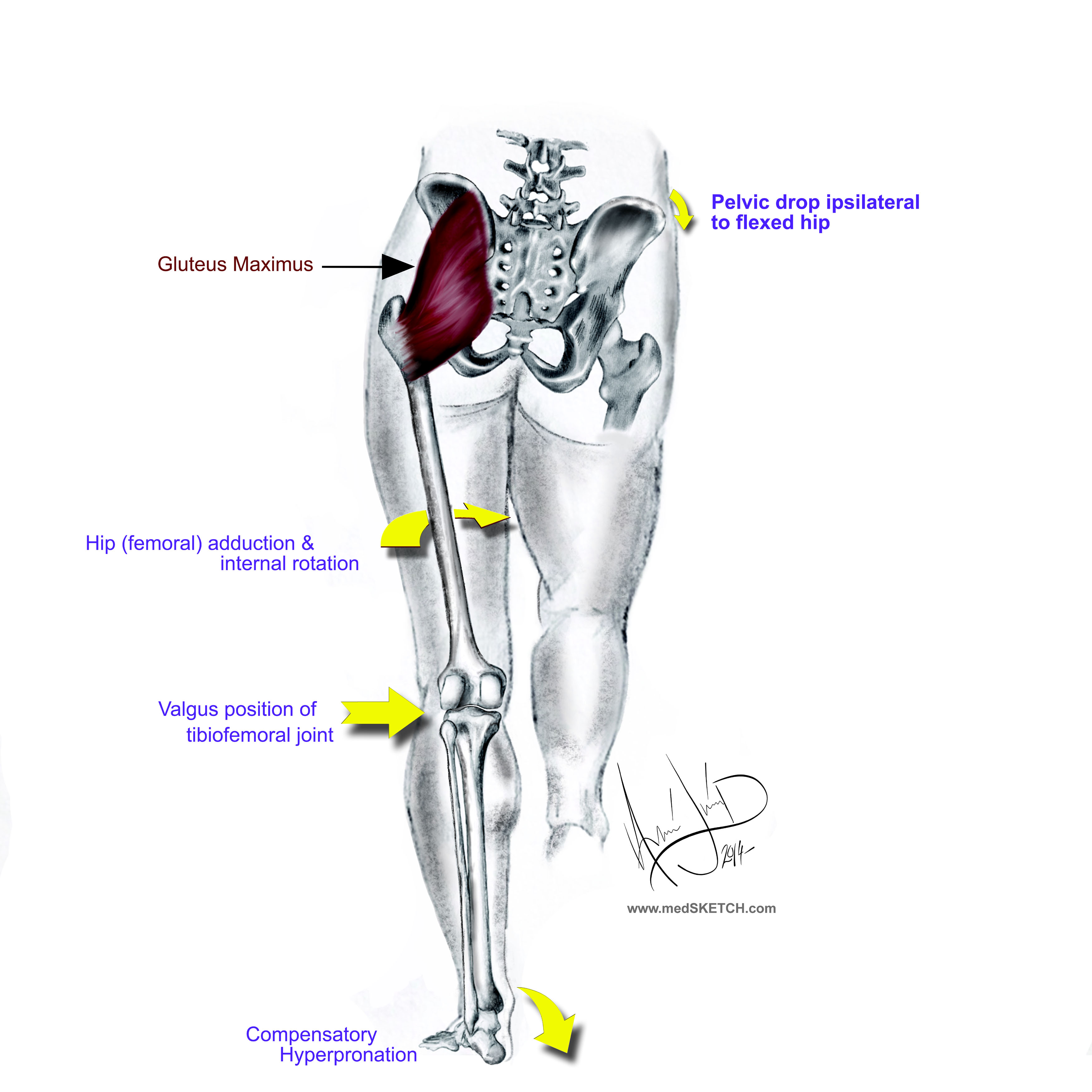 The Gluteal Knee Connection Part Two Dr William E Morgan the-gluteal-knee-connection-part-two-dr-william-e-morgan