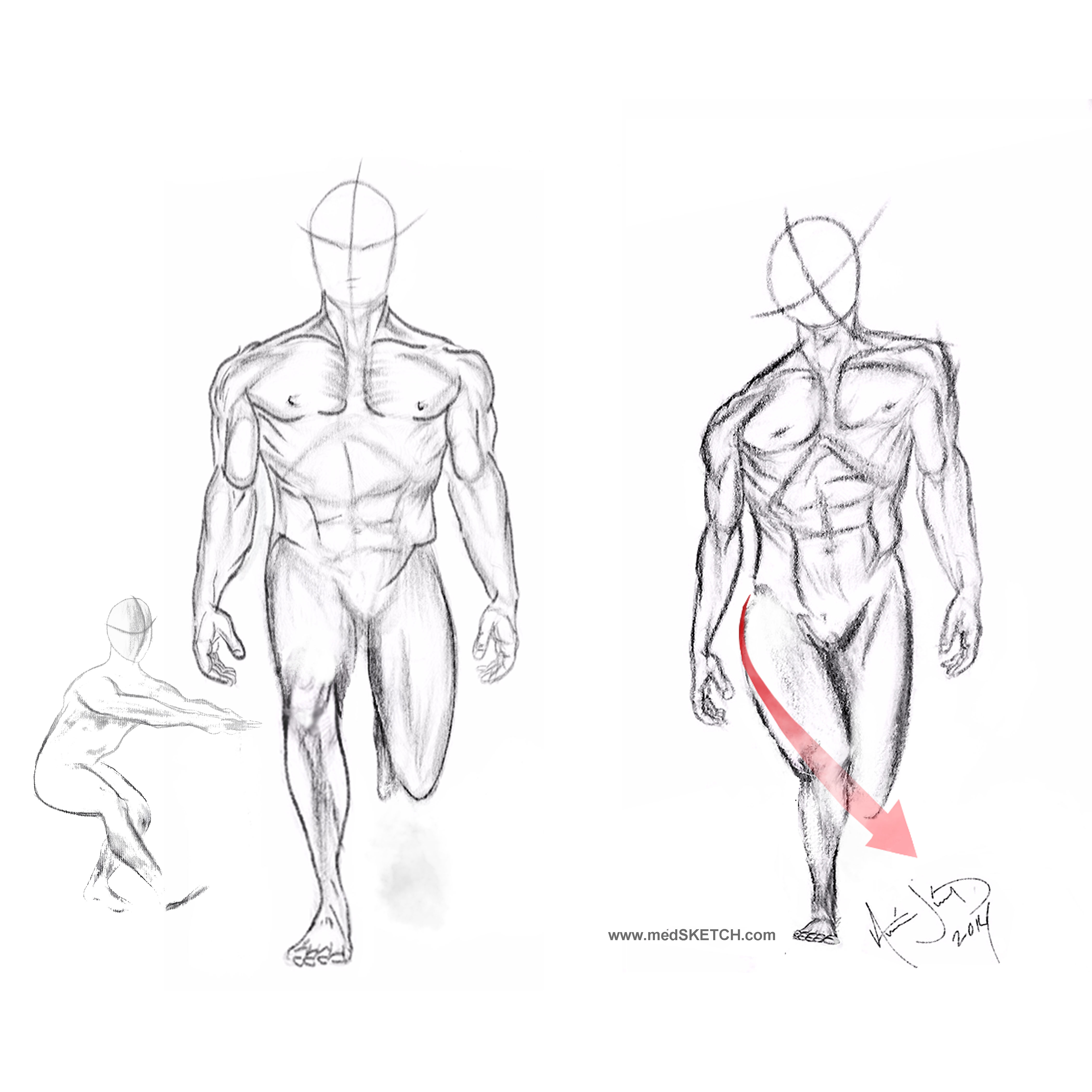 Figure 4.  Testing for gluteus maximus weakness.  Clinical testing of the GM can be done by having the patient perform a one leg squat or hop or by watching the patient descend stairs.  The knee should track down straight in alignment with the tibia and femur (left image).  If the knee migrates medially (right image), it indicates a motion pattern fault and likely a weak gluteus maximus. 